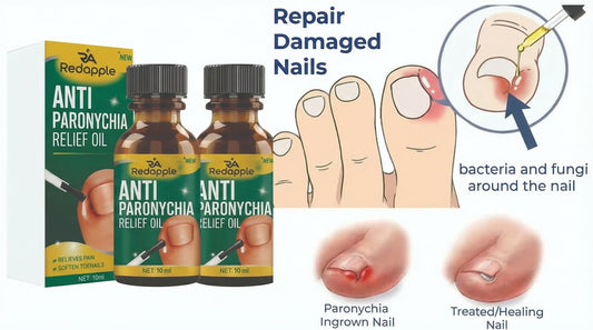 Anti Paronychia Relief Oil